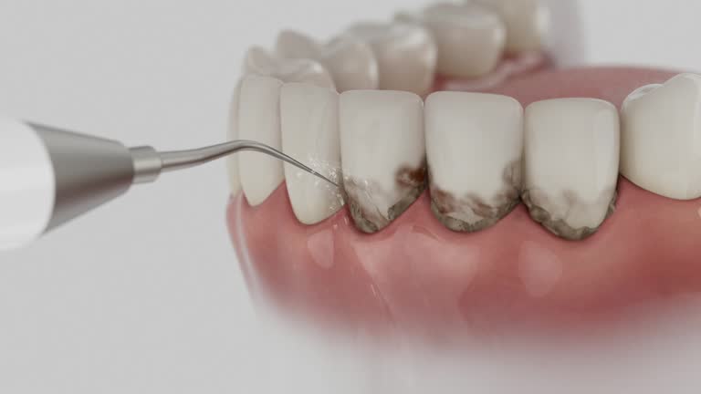 Trusted Tooth Extraction service in Elkhorn, CA - Dentist Open Now